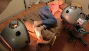 子供のIgA血管炎のコウケントー光線治療方法