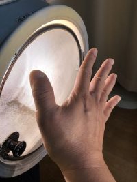 リウマチ、ヘバーデン結節、突き指、指の切り傷、指のやけどなどは、指全部をコウケントー光線照射する。