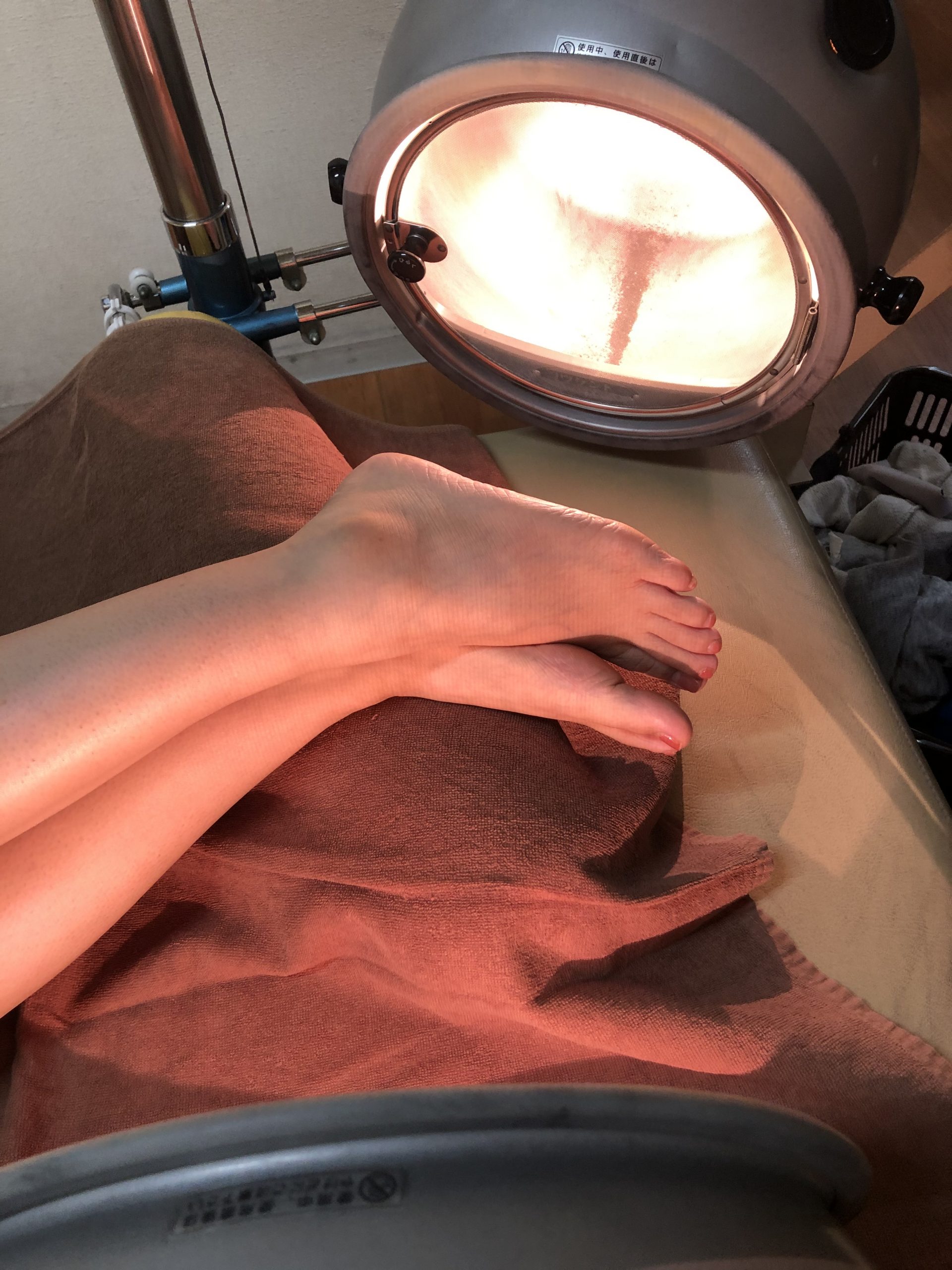 N・Yさん73歳女性、冷え症と35℃台の低体温改善のコウケントー光線療法