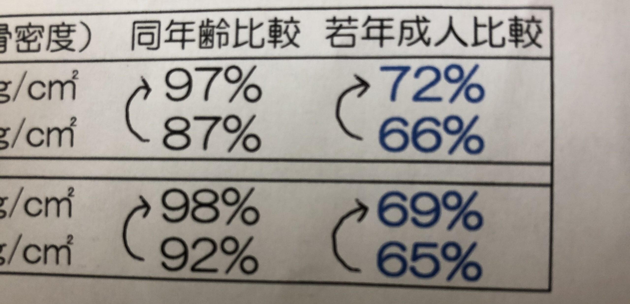 骨粗鬆症にはコウケントー光線治療がおススメ。当てているだけで自然に骨密度は上がります。