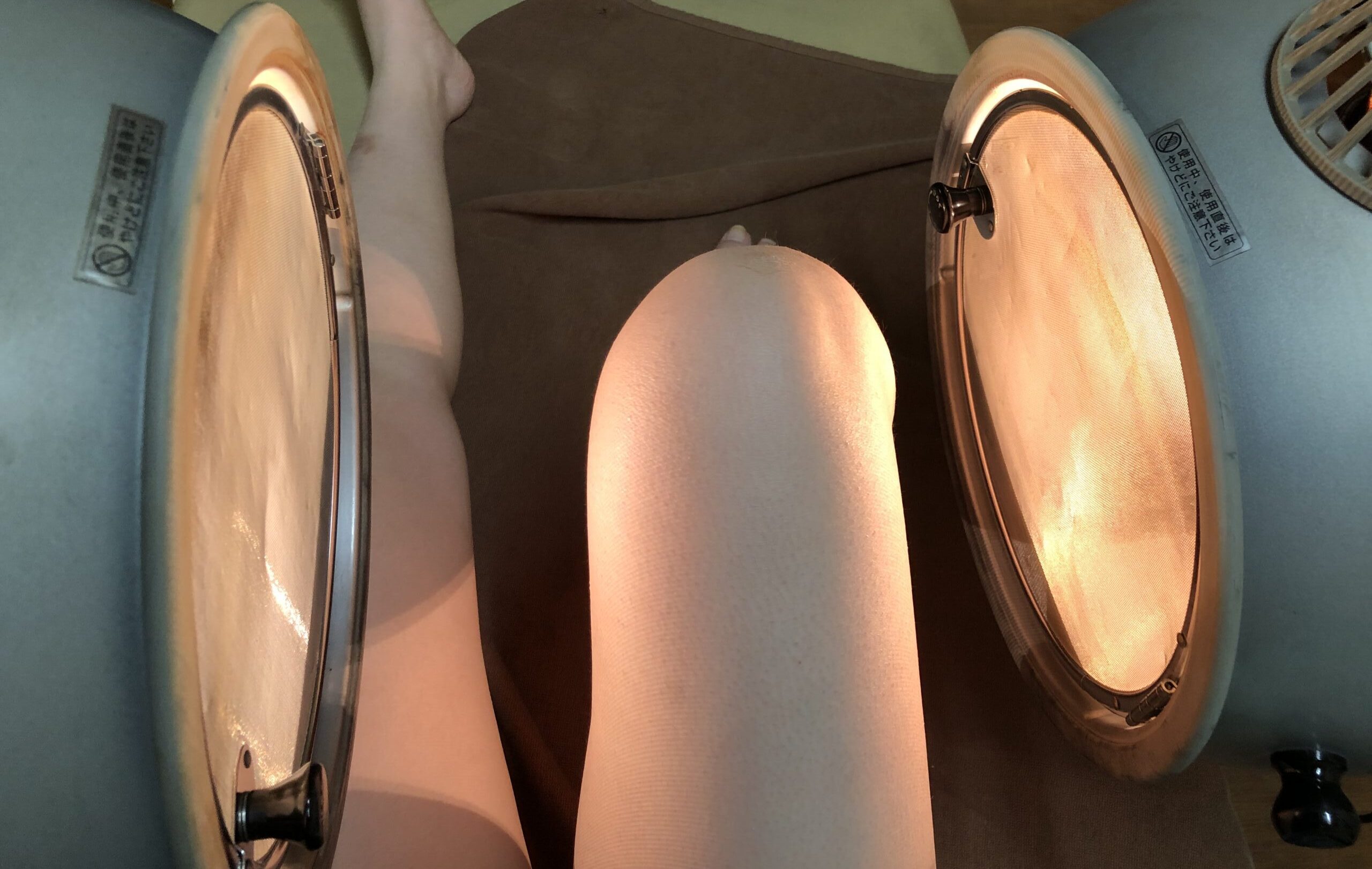 50代男性、60代女性他、マラソンで膝の半月板損傷時のコウケントー光線治療